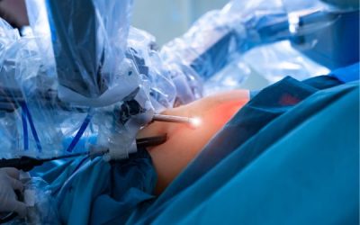 Cirugía Mínimamente Invasiva en la Medicina Moderna